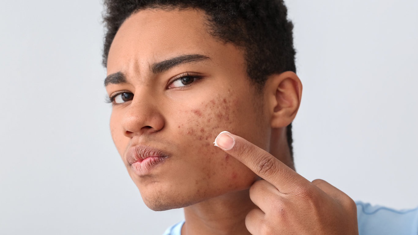 Why one Ingredient is never enough to fade dark marks?